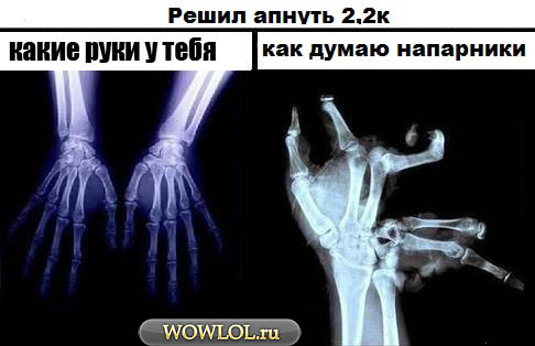 Руки